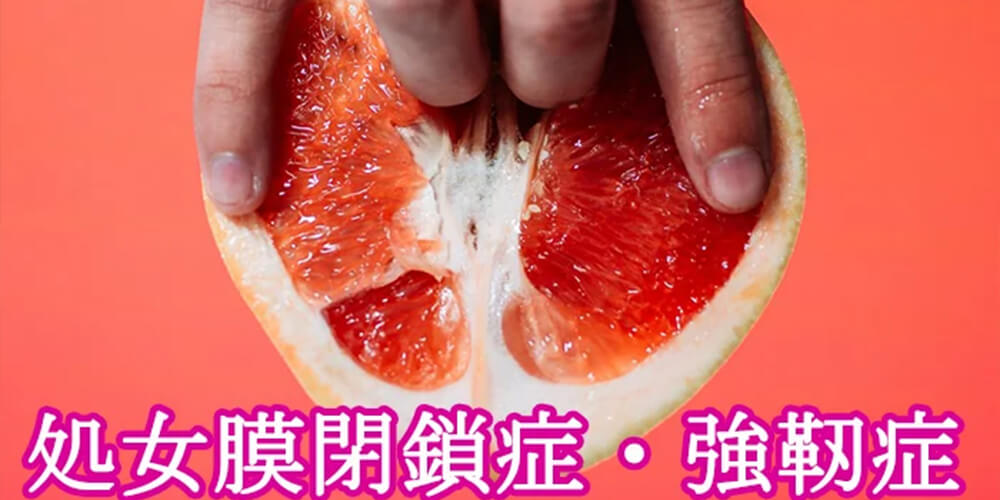 処女膜異常、処女膜閉鎖症、処女膜強靭症とその解決方法を解説　